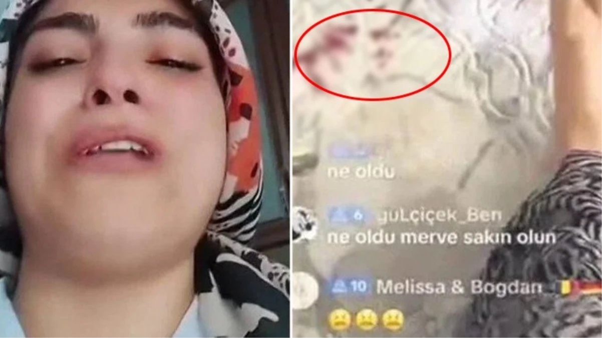 TikTok'taki rezaletler bitmiyor! Çocuğu kanlar içindeyken canlı yayın açtı